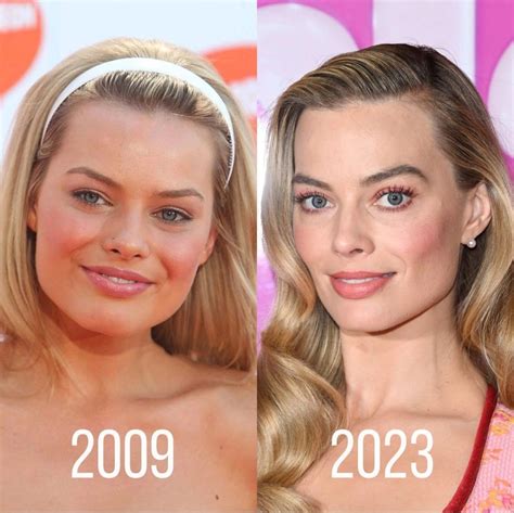 margot robbie before and after surgery|Margot Robbie before and after: The Barbie Plastic Surgery ...